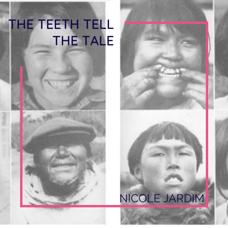 The Teeth Tell the Tale