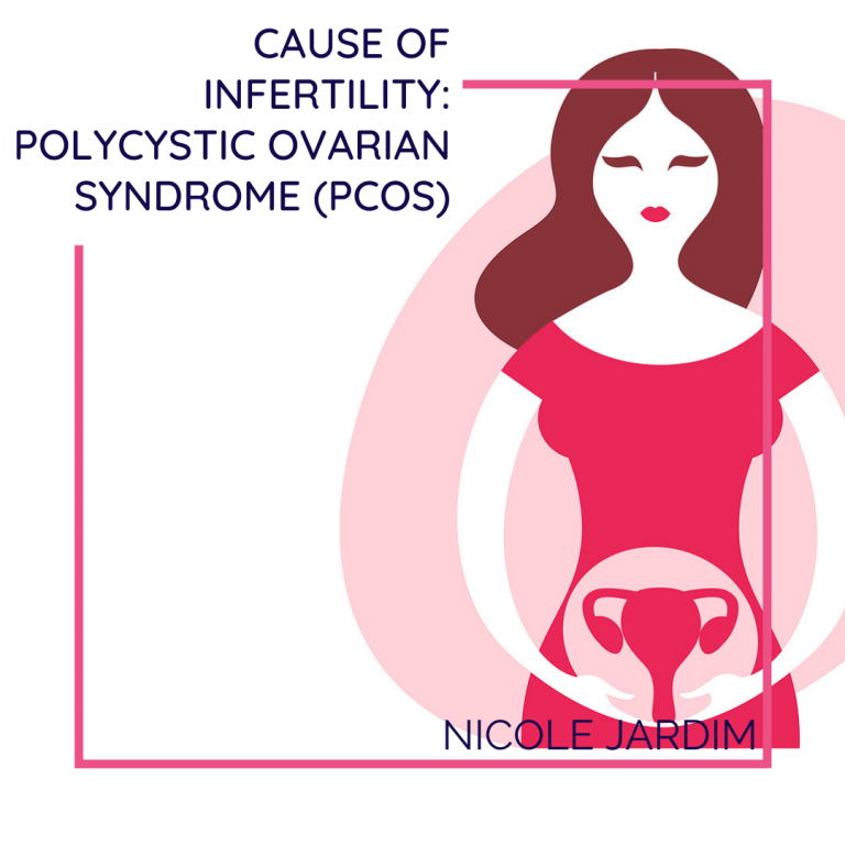 Cause of Infertility_ Polycystic Ovarian Syndrome (PCOS)