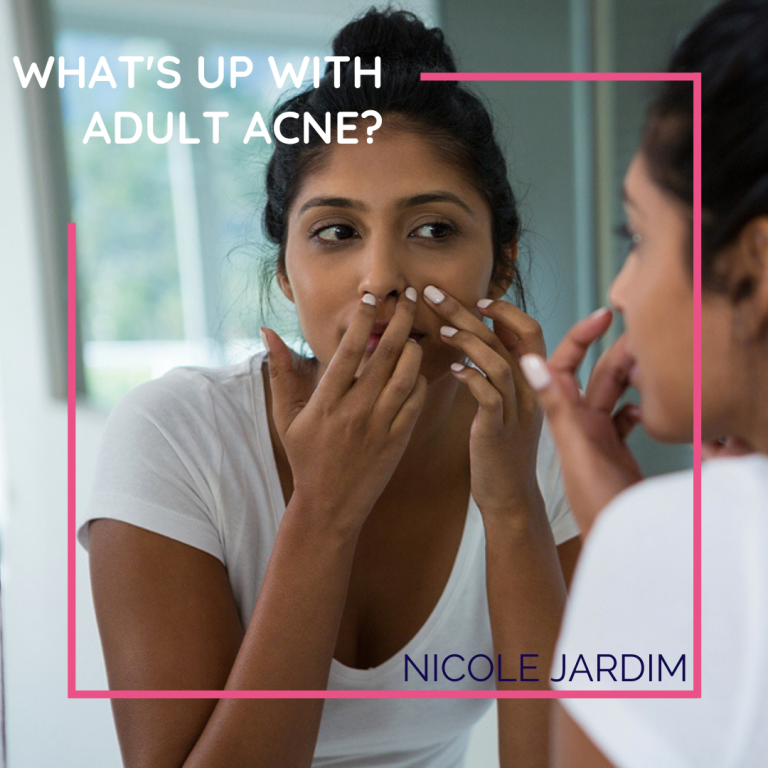 What's up with Adult Acne?