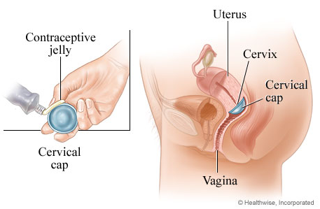 Diaphragm