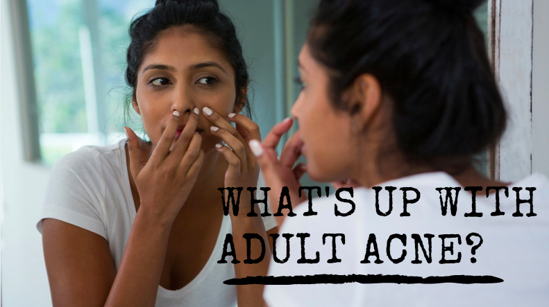 What's up with Adult Acne?