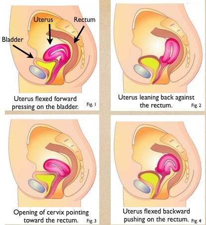 Uterine Positions