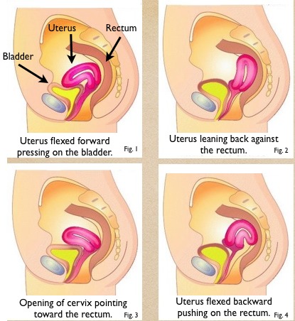 Period Stops and Starts Again: What's Causing It?